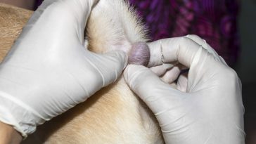 tumor