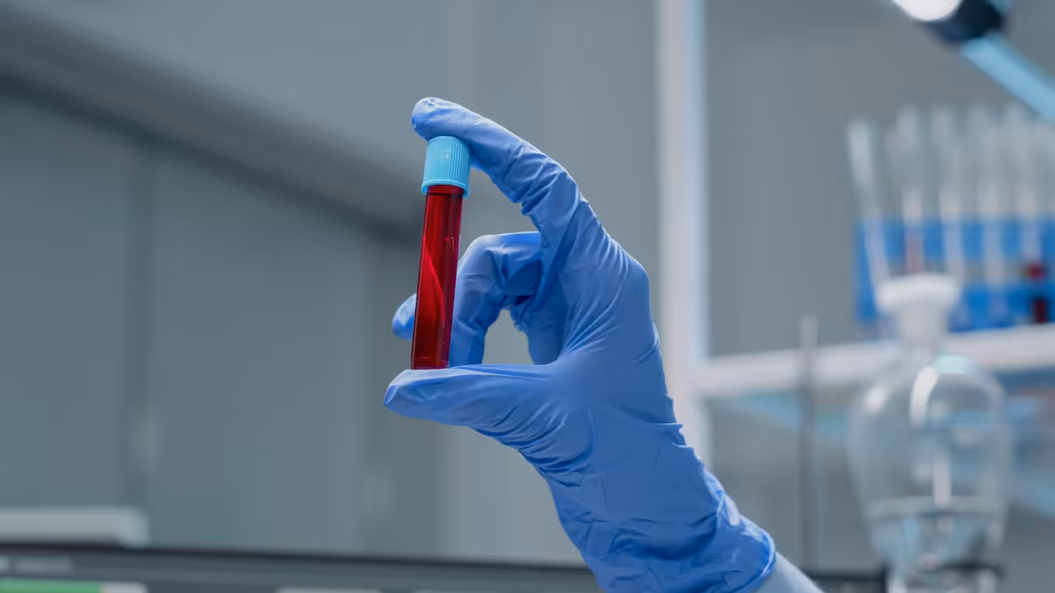 SDMA ou ureia e creatinina: qual o melhor para o estadiamento da doença renal em pets?
