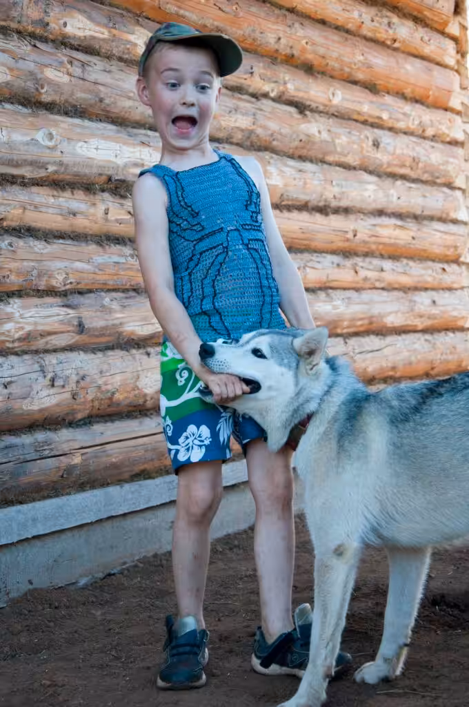 Dog bites child's hand