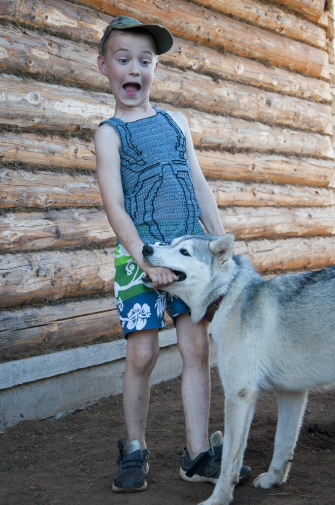 Dog bites child's hand