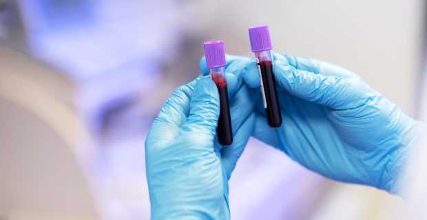 hematologia