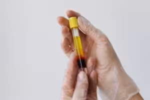 O uso de plasma em pet foods